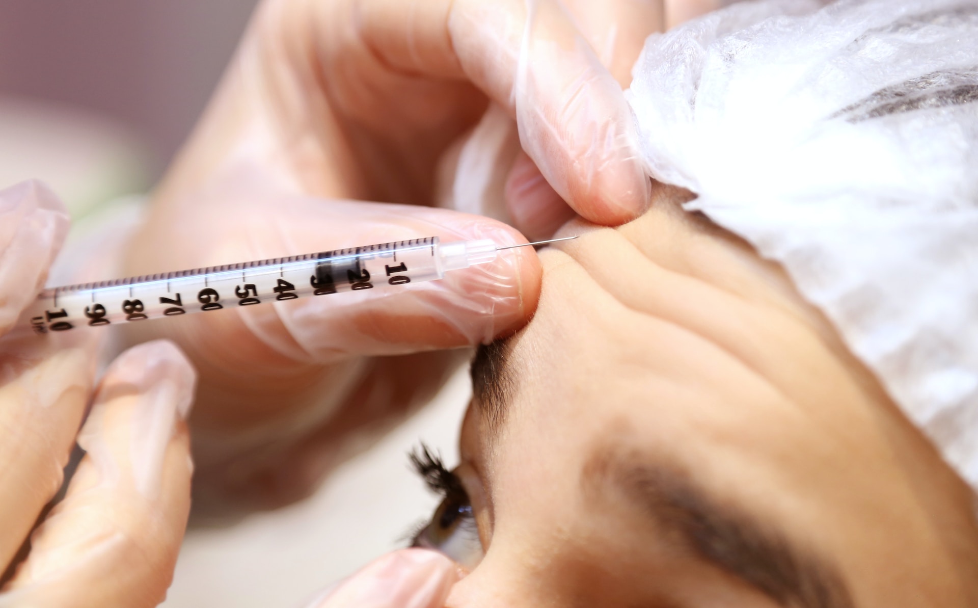 Botox for Migraines: What You Should Know