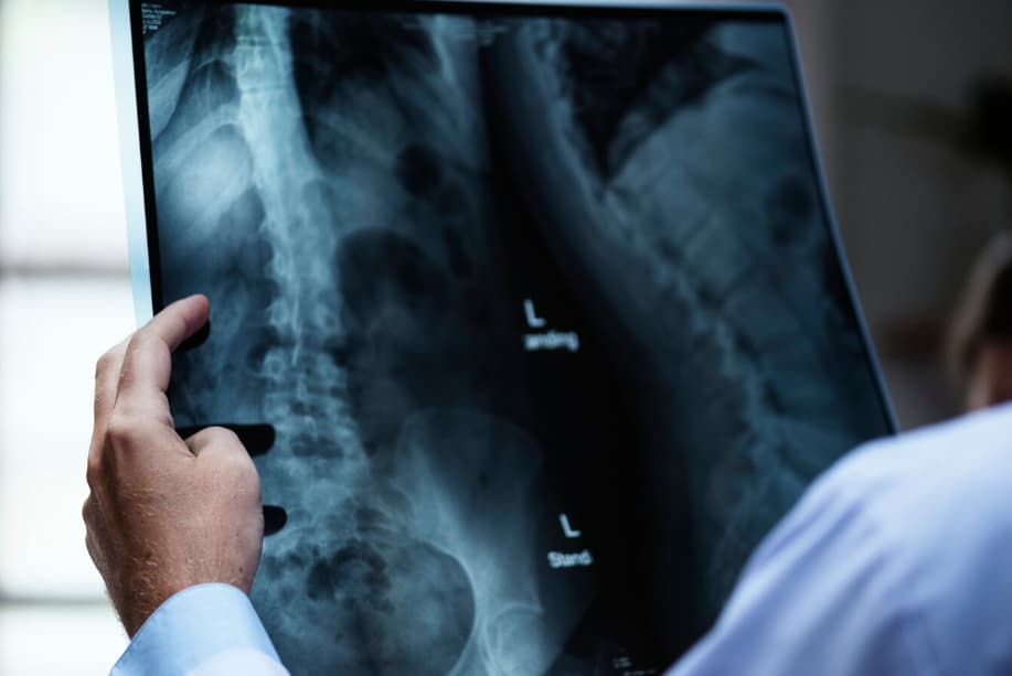 How a Spine Surgeon Can Help You Avoid Long-Term Back Issues